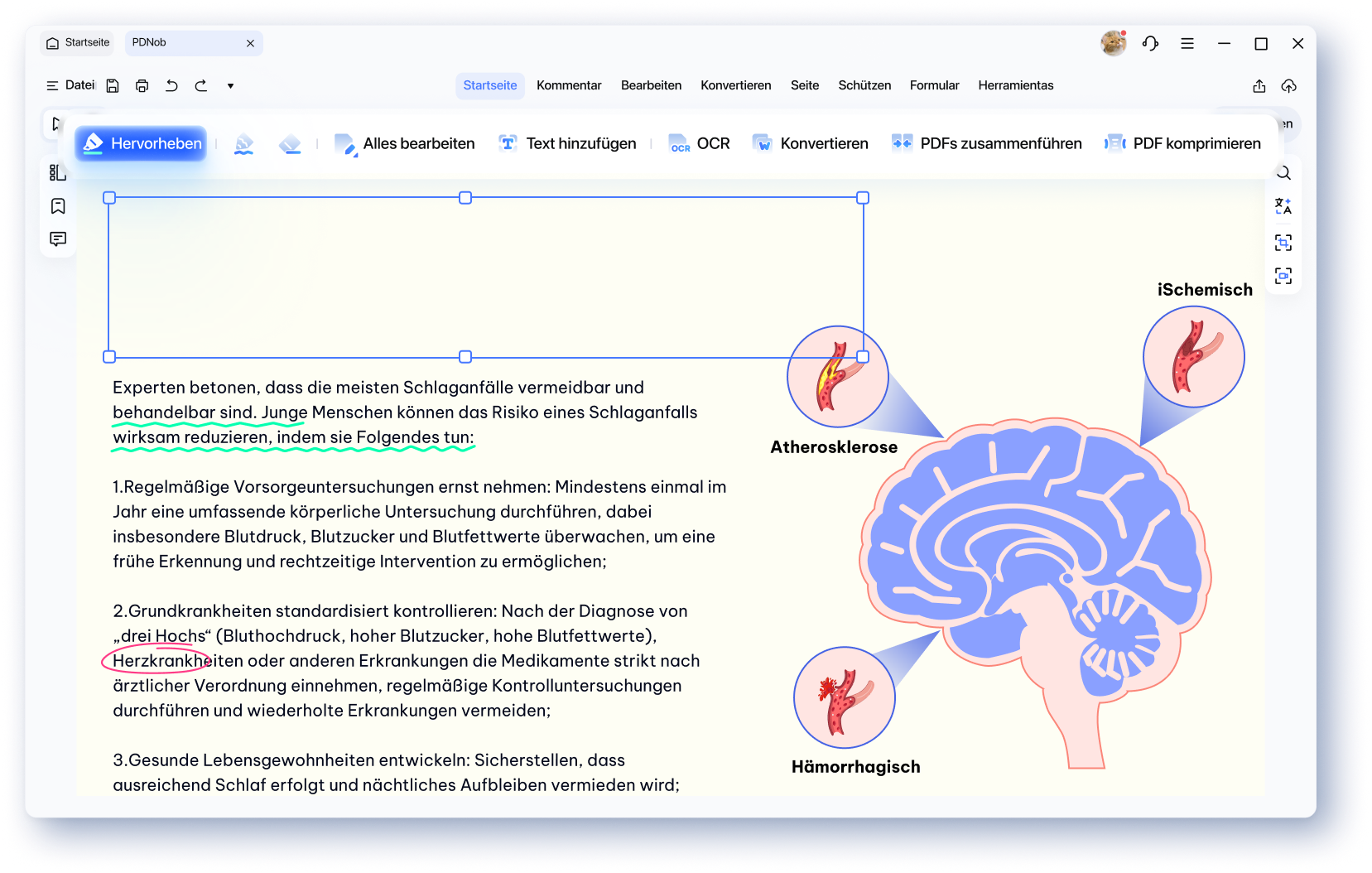 Comment Follow the Text